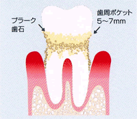 画像の説明