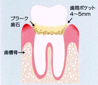 画像の説明